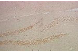 Immunohistochemistry of paraffin-embedded Mouse hippocampus tissue using NFκB-p65 Monoclonal Antibody at dilution of 1:200. (NF-kB p65 anticorps)