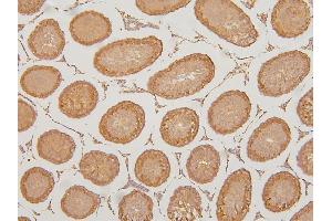 IHC analysis of KIF15 using anti-KIF15 antibody (ABIN6719385).