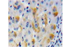 Used in DAB staining on fromalin fixed paraffin-embedded Liver tissue (MMP15 anticorps  (AA 336-539))