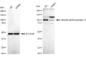 Western blotting analysis using Ubiquitin specific peptidase 13 antibody (ABIN7800726). (Recombinant USP13 anticorps)