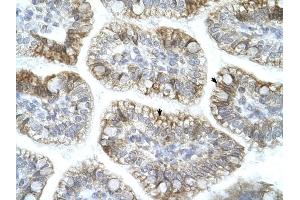 APBA1 antibody was used for immunohistochemistry at a concentration of 4-8 ug/ml to stain Epithelial cells of intestinal villus (arrows) in Human Intestine. (APBA1 anticorps  (N-Term))