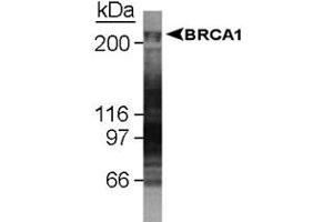 Western blot analysis of BRCA1 in U-2 OS whole cell lysate using BRCA1 monoclonal antibody, clone KEN . (BRCA1 anticorps  (AA 1314-1864))