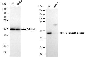 Western blotting analysis using C-terminal Src kinase antibody (ABIN7797814).