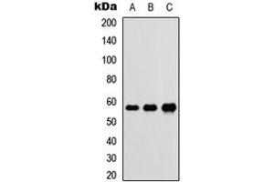 Western blot analysis of DnaJC3 expression in HEK293T (A), Raw264. (DNAJC3 anticorps  (Center))