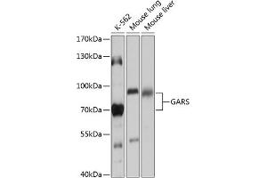 Western blot analysis of extracts of various cell lines, using GARS antibody (ABIN6127941, ABIN6140963, ABIN6140965 and ABIN6217253) at 1:1000 dilution. (GARS anticorps  (AA 60-370))