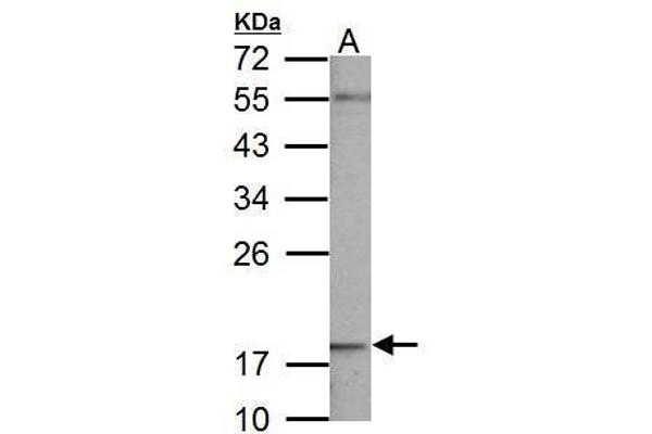 NDUFB5 anticorps  (C-Term)