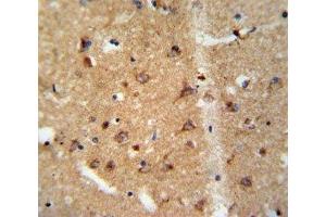 IHC analysis of FFPE human brain tissue stained with GDNF antibody (GDNF anticorps  (AA 8-36))