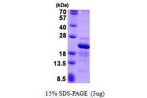 Image no. 1 for Ribosomal Protein S10 (RPS10) protein (His tag) (ABIN1098579)