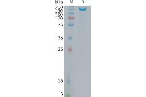 Human I Protein, hFc Tag on SDS-PAGE under reducing condition.