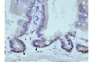THOC1 antibody was used for immunohistochemistry at a concentration of 0. (THOC1 anticorps  (C-Term))