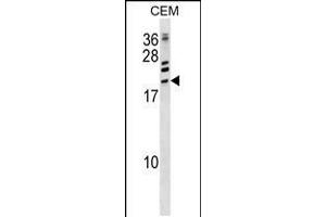 Western blot analysis in CEM cell line lysates (35ug/lane). (ATF3 anticorps  (C-Term))