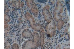 Detection of Hepc in Human Stomach Tissue using Polyclonal Antibody to Hepcidin (Hepc)