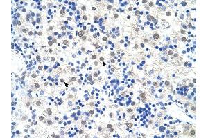 DDX47 antibody was used for immunohistochemistry at a concentration of 4-8 ug/ml to stain Hepatocytes (arrows) in Human Liver. (DDX47 anticorps)