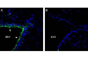 Expression of Parkin in rat  brain 4th ventricle. (Parkinson Protein 2, E3 Ubiquitin Protein Ligase (Parkin) (PARK2) Peptide)