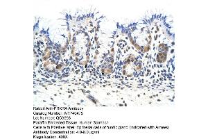 Rabbit Anti-PRKRA Antibody  Paraffin Embedded Tissue: Human Stomach Cellular Data: Epithelial cells of fundic gland Antibody Concentration: 4. (PRKRA anticorps  (Middle Region))