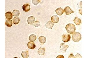 Immunohistochemistry (IHC) image for anti-Metastasis Associated 1 Family, Member 2 (MTA2) antibody (ABIN1031775) (MTA2 anticorps)