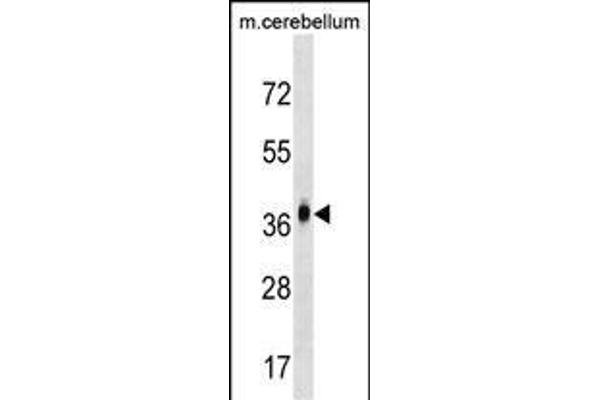 MMD2 Antikörper  (N-Term)