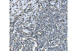 IHC analysis of SPG3A/ATL1 using anti-SPG3A/ATL1 antibody (ABIN7603095).