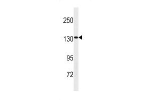 SS2 Antibody (Center) 20308c western blot analysis in HepG2 cell line lysates (35 μg/lane). (SAPS2 anticorps  (AA 565-593))