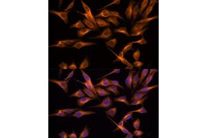 Immunofluorescence analysis of HeLa cells using UNG antibody (ABIN6135163, ABIN6149935, ABIN6149937 and ABIN6217044) at dilution of 1:100. (UNG anticorps  (AA 1-100))