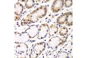 Immunohistochemistry of paraffin-embedded human colon using RNF2 antibody.