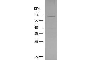 Western Blotting (WB) image for Vinculin (VCL) (AA 777-1066) protein (GST tag) (ABIN7125717)