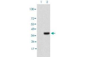 Western blot analysis of Lane 1: HEK293T cell lysate, Lane 2: IL3RA (a. (IL3RA anticorps)