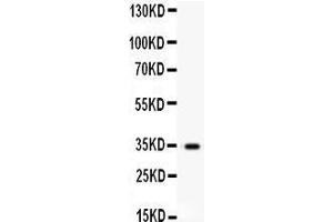 Anti- HGF antibody, Western blotting All lanes: Anti HGF  at 0. (HGF anticorps  (N-Term))