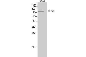 Western Blotting (WB) image for anti-Tripartite Motif Containing 3 (TRIM3) (N-Term) antibody (ABIN3187338) (TRIM3 anticorps  (N-Term))