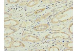 Immunohistochemistry of paraffin-embedded human kidney tissue using ABIN7170943 at dilution of 1:100 (Sulfide:quinone Oxidoreductase, Mitochondrial (SQOR) (AA 211-450) anticorps)