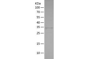 Western Blotting (WB) image for Interferon Regulatory Factor 7 (IRF7) (AA 67-287) protein (His tag) (ABIN7123500)