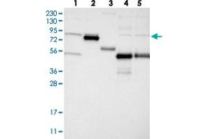 Western blot analysis of Lane 1: RT-4, Lane 2: U-251 MG, Lane 3: Human Plasma, Lane 4: Liver, Lane 5: Tonsil with GLT25D2 polyclonal antibody  at 1:250-1:500 dilution. (GLT25D2 anticorps)