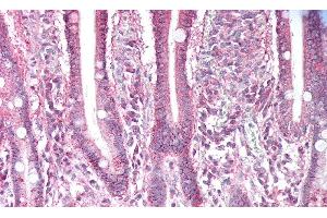 Detection of ABP1 in Human Small Intestine Tissue using Polyclonal Antibody to Amiloride Binding Protein 1 (ABP1)