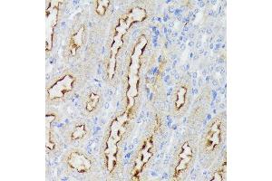 Immunohistochemistry of paraffin-embedded mouse kidney using Nectin 2/CD112 Rabbit mAb (ABIN7269432) at dilution of 1:100 (40x lens). (PVRL2 anticorps)