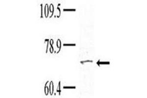 Western blot analysis of TNK1 antibody (1:100) in HeLa lysate