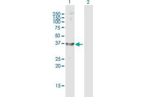 Western Blot analysis of AKR1C4 expression in transfected 293T cell line by AKR1C4 MaxPab polyclonal antibody.