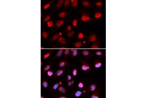 Immunofluorescence (IF) image for anti-Ring Finger Protein 2 (RNF2) antibody (ABIN1876743) (RNF2 anticorps)
