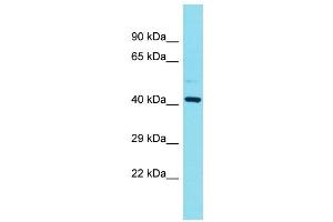 Western Blotting (WB) image for anti-Family with Sequence Similarity 181, Member B (FAM181B) (N-Term) antibody (ABIN2791533) (FAM181B anticorps  (N-Term))
