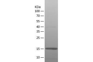 Western Blotting (WB) image for Glial Fibrillary Acidic Protein (GFAP) (AA 292-432) protein (His tag) (ABIN7123094)