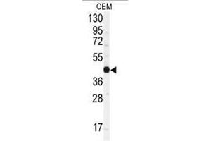 Image no. 1 for anti-Gap Junction Protein, alpha 1, 43kDa (GJA1) (N-Term) antibody (ABIN357085) (Connexin 43/GJA1 anticorps  (N-Term))