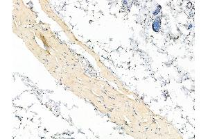 Phospho-CXCR4 (Ser339) Antibody at 1/100 staining Rat skin tissue by IHC-P. (CXCR4 anticorps  (pSer339))