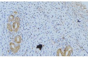 ABIN6268862 at 1/100 staining Human uterus tissue by IHC-P.