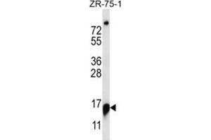 Western Blotting (WB) image for anti-Ribonuclease P/MRP 25kDa Subunit (RPP25) antibody (ABIN2997146)