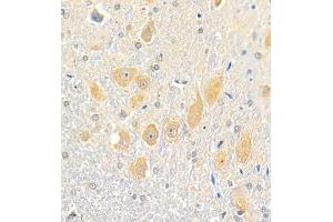 Immunohistochemistry analysis of paraffin embedded rat cerebellum using Erc2 (ABIN7073808) at dilution of 1: 3000