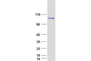 Validation with Western Blot