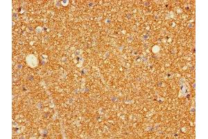 Immunohistochemistry of paraffin-embedded human brain tissue using ABIN7153961 at dilution of 1:100 (Glutamate Receptor 3 anticorps  (AA 151-250))