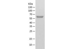 Western Blotting (WB) image for Valosin Containing Protein (VCP) (AA 1-589) protein (His-IF2DI Tag) (ABIN7125694)