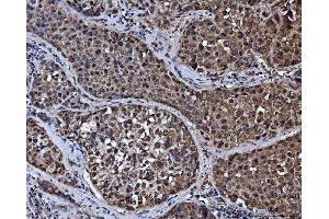 IHC analysis of TRMT10C using anti-TRMT10C antibody (ABIN7601472).