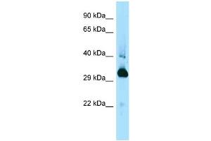 WB Suggested Anti-Mapre1 Antibody Titration: 1. (MAPRE1 anticorps  (C-Term))