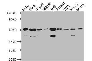 Western Blot Positive WB detected in: Hela whole cell lysate, K562 whole cell lysate, HepG2 whole cell lysate, HEK293 whole cell lysate, L02 whole cell lysate, Jurkat whole cell lysate, SH-SY5Y whole cell lysate, Mouse Brain whole cell lysate, Rat Brain cell lysate All lanes: RbAp48 antibody at 1:1000 Secondary Goat polyclonal to rabbit IgG at 1/50000 dilution Predicted band size: 48, 48, 47, 44 kDa Observed band size: 53, 40 kDa (Recombinant Retinoblastoma Binding Protein 4 anticorps)